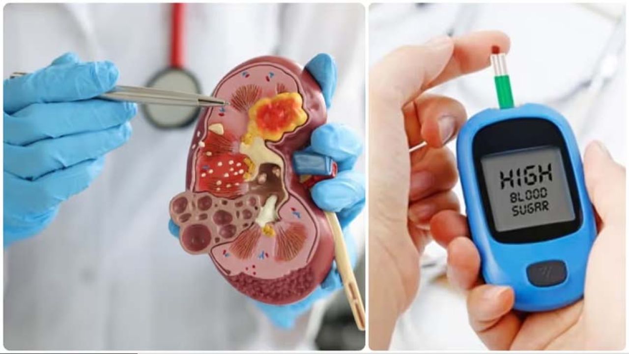 ডায়াবেটিস বাড়ায় কিডনি রোগের ঝুঁকি