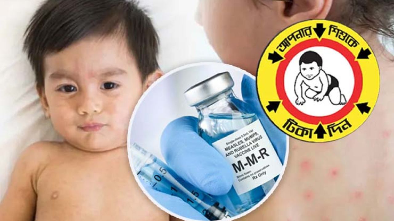 কাল থেকে ৪ সিটিতে হামের টিকা শুরু, যাদের না দেয়ার পরামর্শ