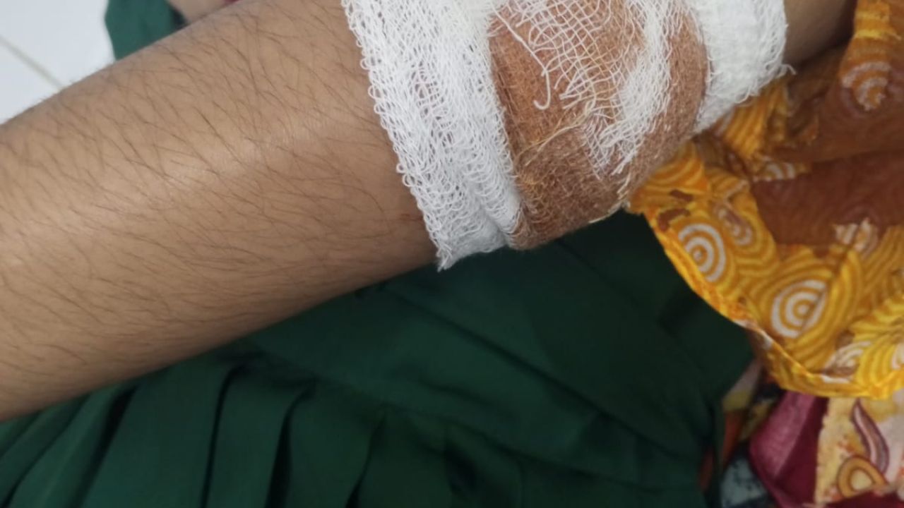 ভালুকায় দুর্বৃত্তের ছুরিকাঘাতে এসএসসি পরীক্ষার্থী আহত