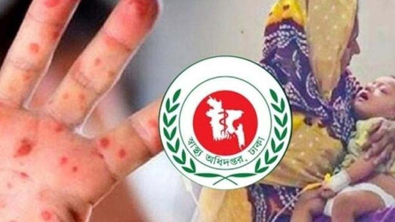 হাম ও উপসর্গে আরও ৯ শিশুর প্রাণহানি