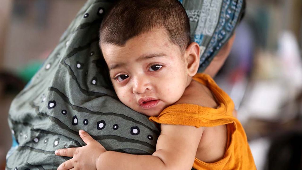 হাম ও উপসর্গে ২৪ ঘণ্টায় ৮ জনের মৃত্যু