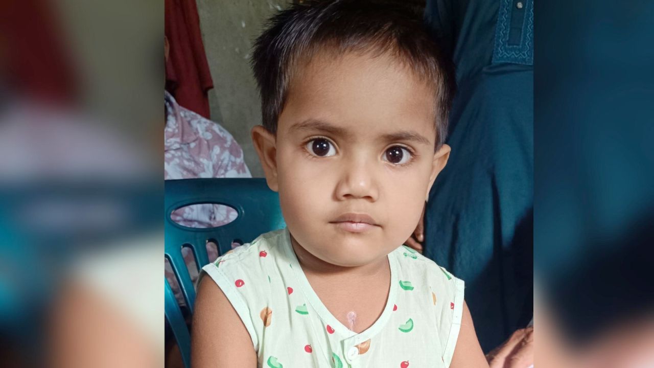 নালিতাবাড়ীর কন্যা শিশু আয়শা সিদ্দিকার সফল অপারেশন