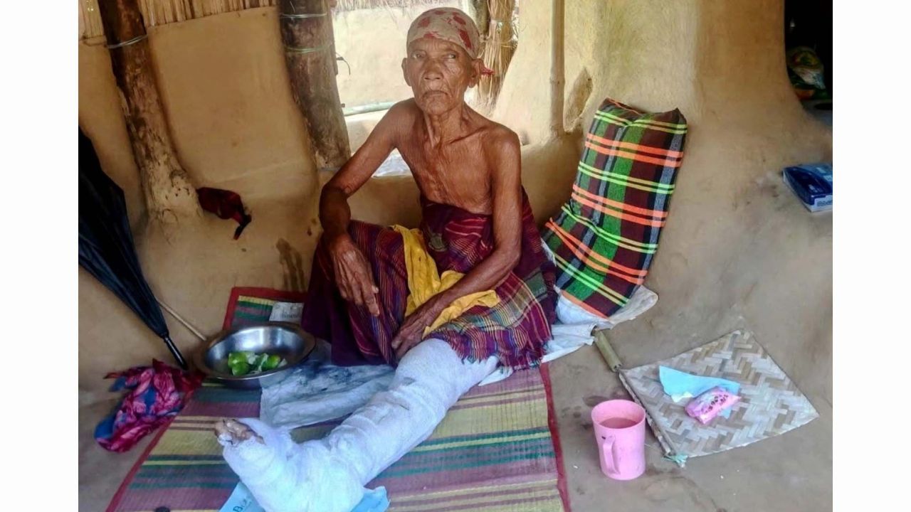 ঝিনাইগাতীতে মোটরসাইকেল ধাক্কায় আহত চির কুমারী বাছকি কোচের অর্থাভাবে চিকিৎসা ব্যাহত