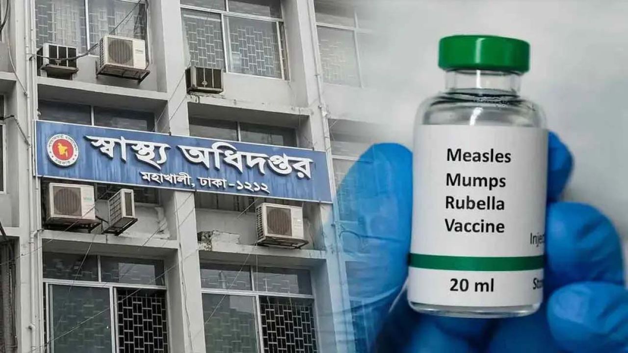 হামের উপসর্গে আরও ৬ জনের মৃত্যু, আক্রান্ত ১ হাজার ৩৯৩