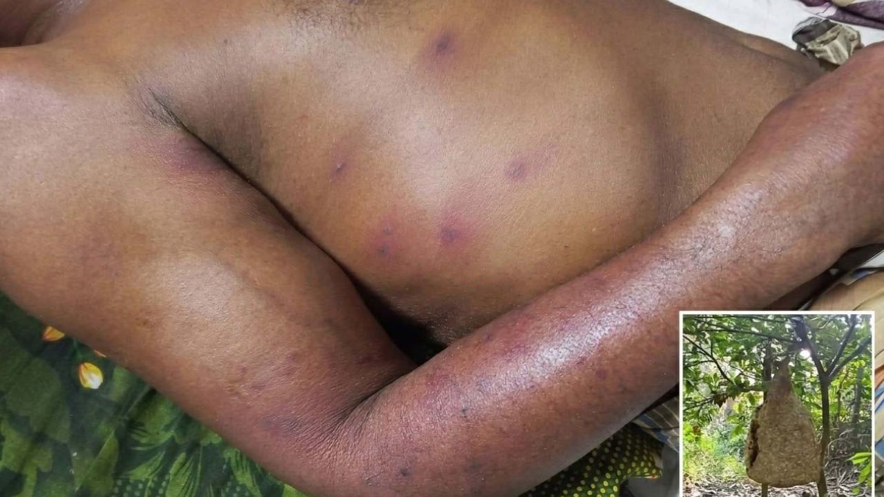 শ্রীবরদীতে  ভিমরুলের কামড়ে কৃষকের মৃত্যু